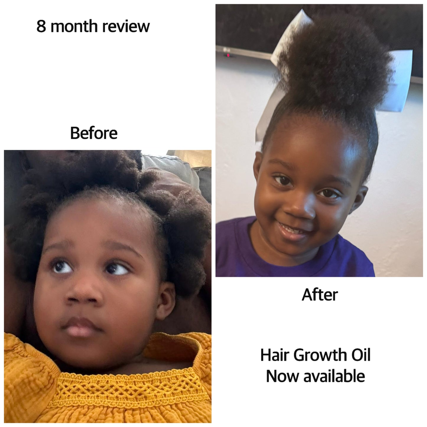 RoBeautee Hair Growth Oil - Robeautee LLC